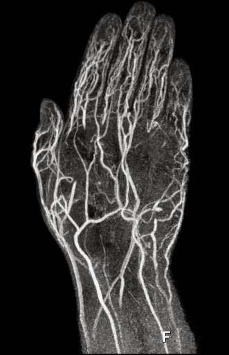MRI Scan photo